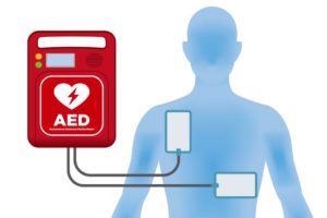 What is an Automated External Defibrillator?
